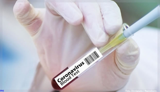 Covid-19: Pfizer e BioNTech desenvolvem potencial vacina