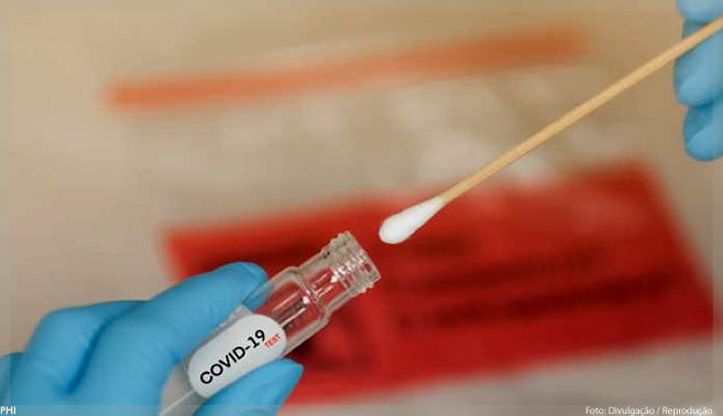 ANS inclui teste sorológico para Covid-19 no rol de coberturas obrigatórias