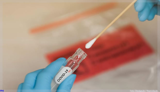 Autorização da UE para teste rápido PCR para COVID-19 da XPhyto